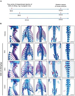 Identification of Jmjd3 as an Essential Epigenetic Regulator of Hox Gene Temporal Collinear Activation for Body Axial Patterning in Mice